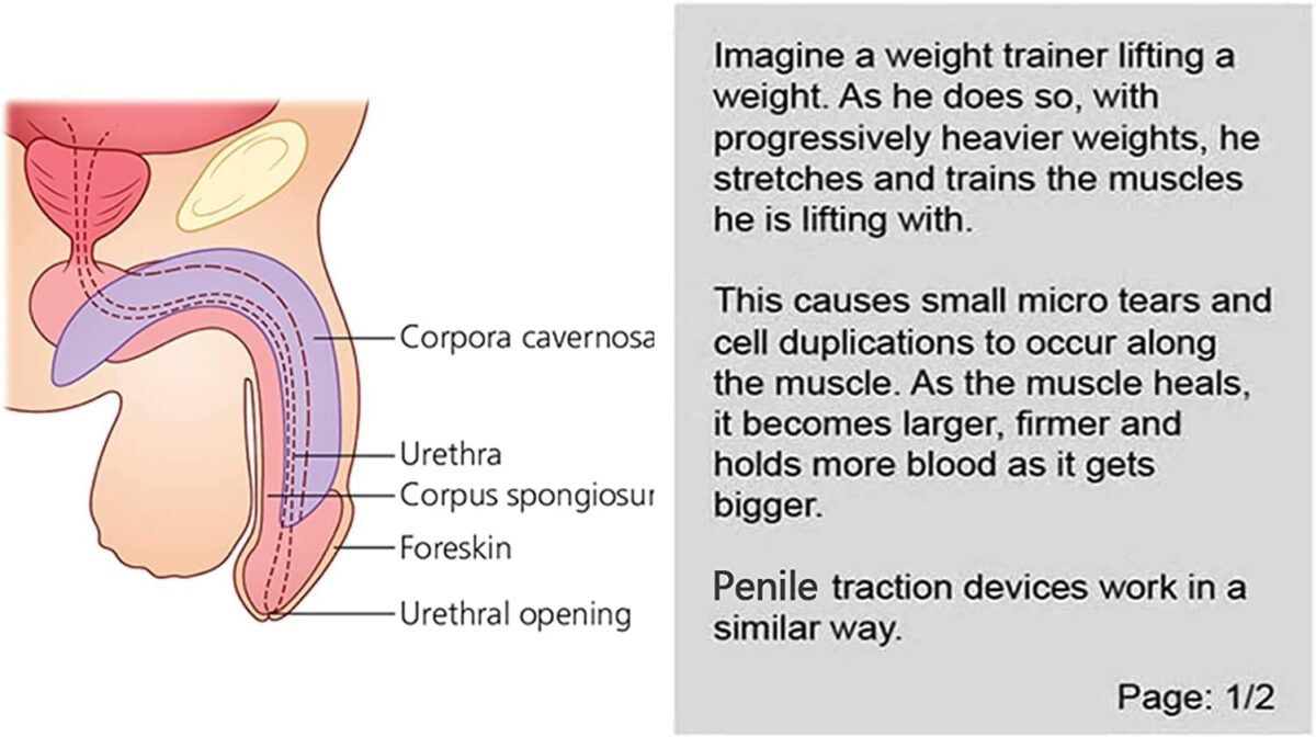 Pro Penis Extender Kit - Image 6